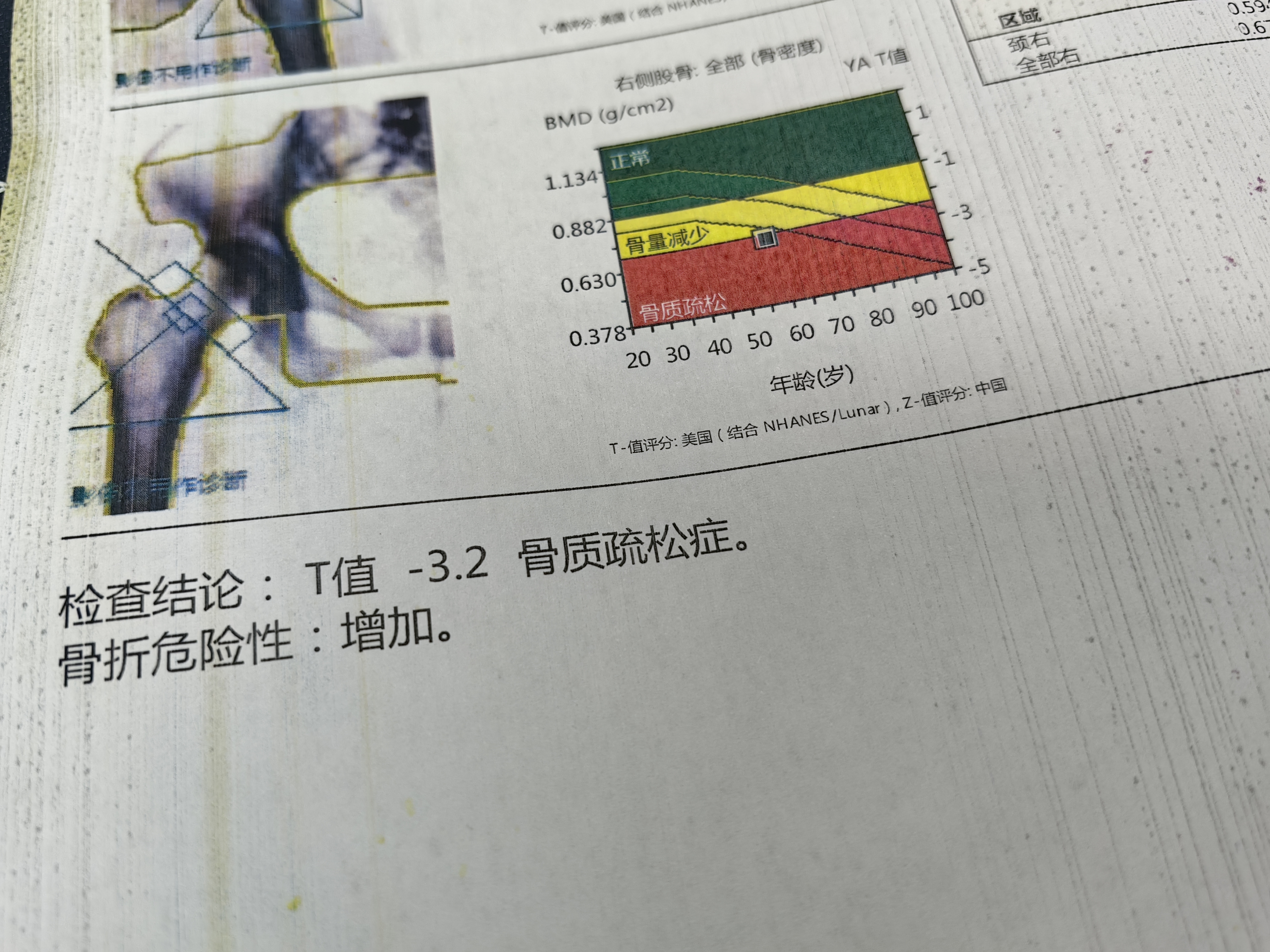 “南京确诊超150例” 南京确诊超150例病例？